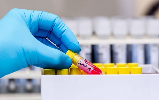 Şimali Koreyada koronavirusa ilk yoluxma halı qeydə alındı